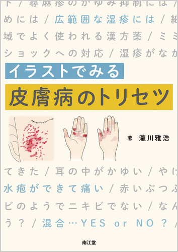 イラストでみる皮膚病のトリセツ 絵本ナビ 瀧川 雅浩 みんなの声 通販