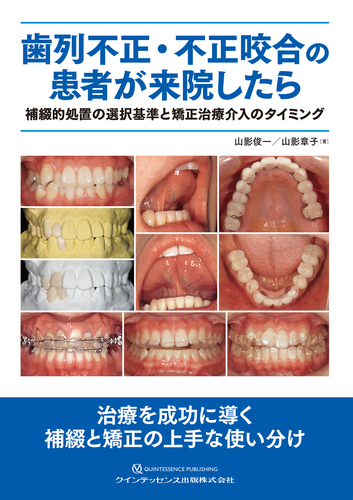 歯列不正・不正咬合の患者が来院したら 補綴的処置の選択基準と矯正治療介入のタイ… 歯列不正・不正咬合の患者が来院したら 補綴的処置の選択基準と