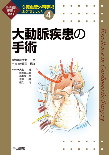 大動脈疾患の手術 第4巻